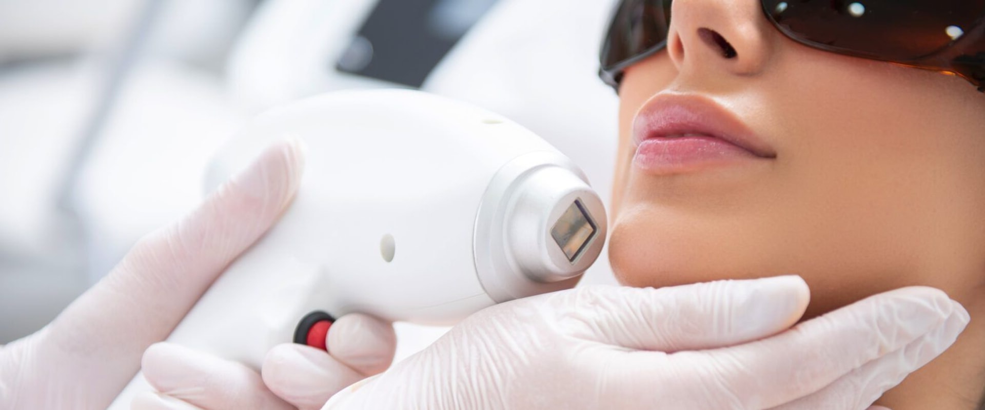 The Benefits and Process of Laser Resurfacing at Medical Spas