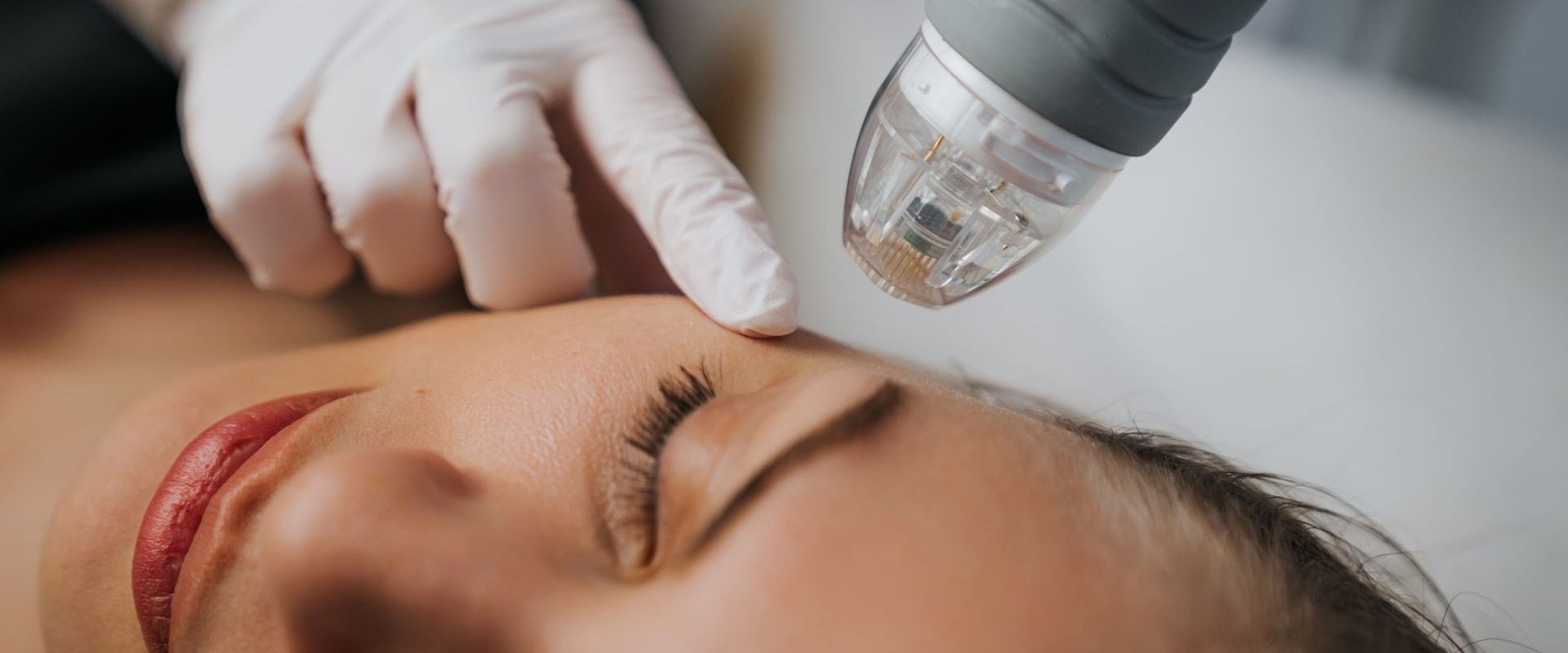 The Power of Microneedling for Skin Rejuvenation at Medical Spas