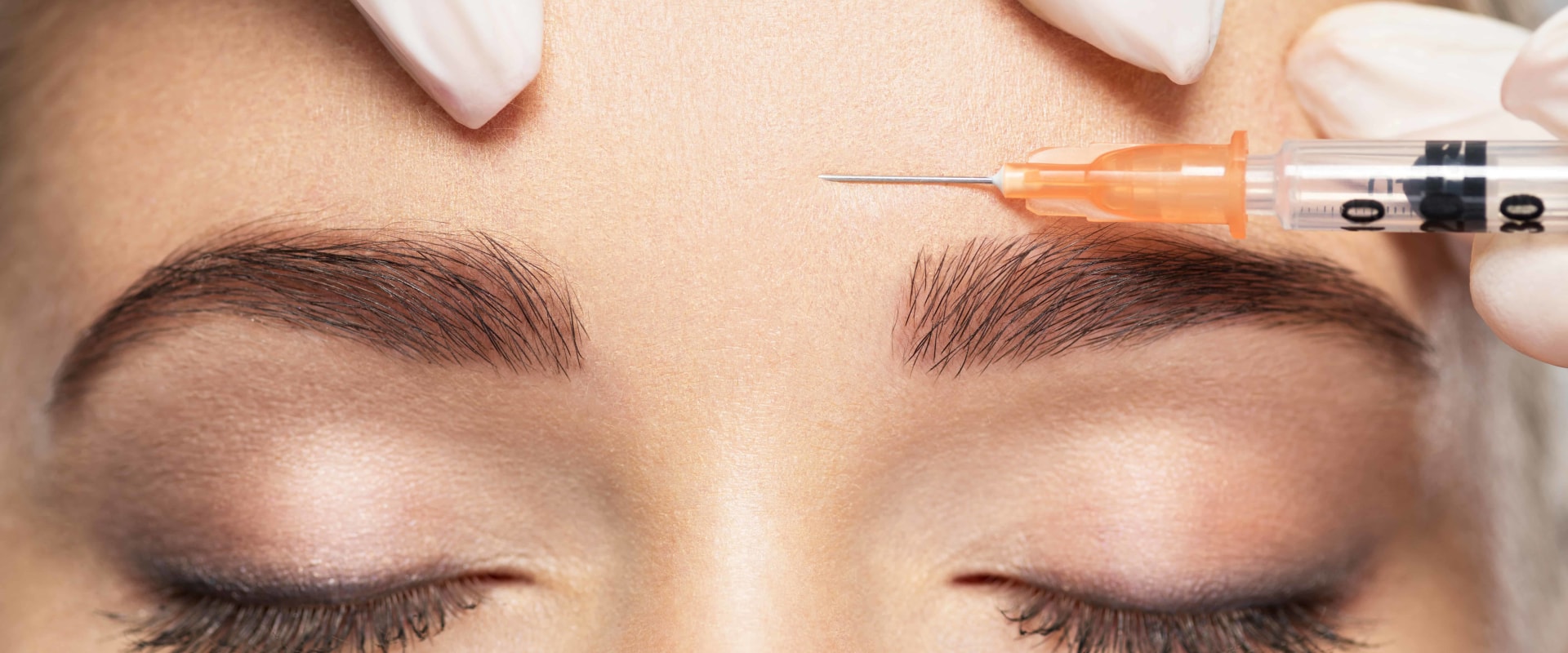 The Benefits and Process of Botox Injections for a Rejuvenated and Refreshed Look