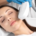 Understanding Intense Pulsed Light (IPL) for Skin Rejuvenation