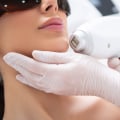 The Benefits and Process of Laser Resurfacing at Medical Spas