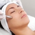 Understanding Microdermabrasion: All You Need to Know About this Anti-Aging Treatment