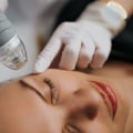 The Power of Microneedling for Skin Rejuvenation at Medical Spas