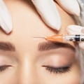 The Benefits and Process of Botox Injections for a Rejuvenated and Refreshed Look