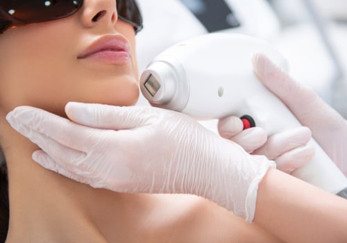 The Benefits and Process of Laser Resurfacing at Medical Spas