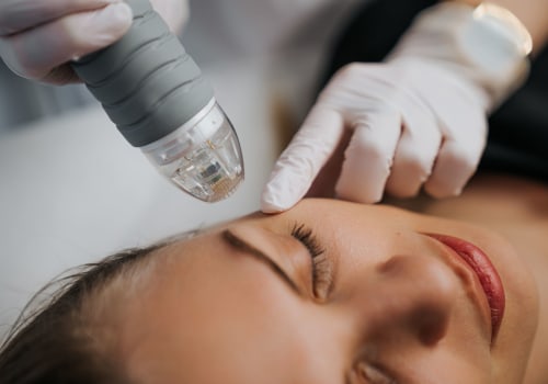 The Power of Microneedling for Skin Rejuvenation at Medical Spas